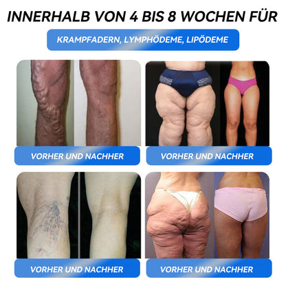 IFMAGIC® GLP-1 Pro Schlankheits-Trinklösung 7 Tage sichtbare Wirkung, keine Nebenwirkungen, geeignet für alle Altersgruppen 🌹